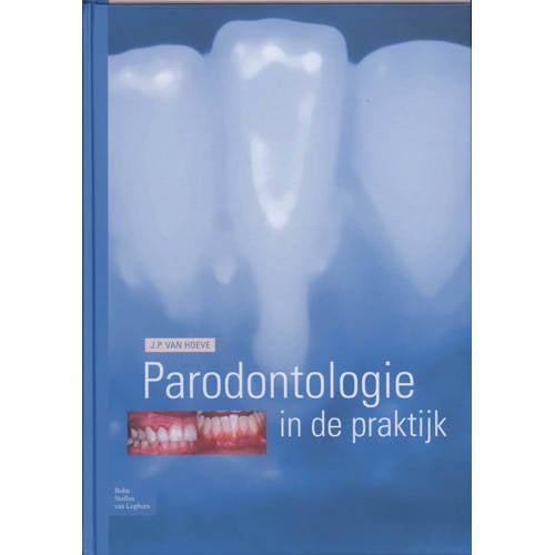 Parodontologie In De Praktijk Jp Van Hoeve huismerk kopen in de aanbieding