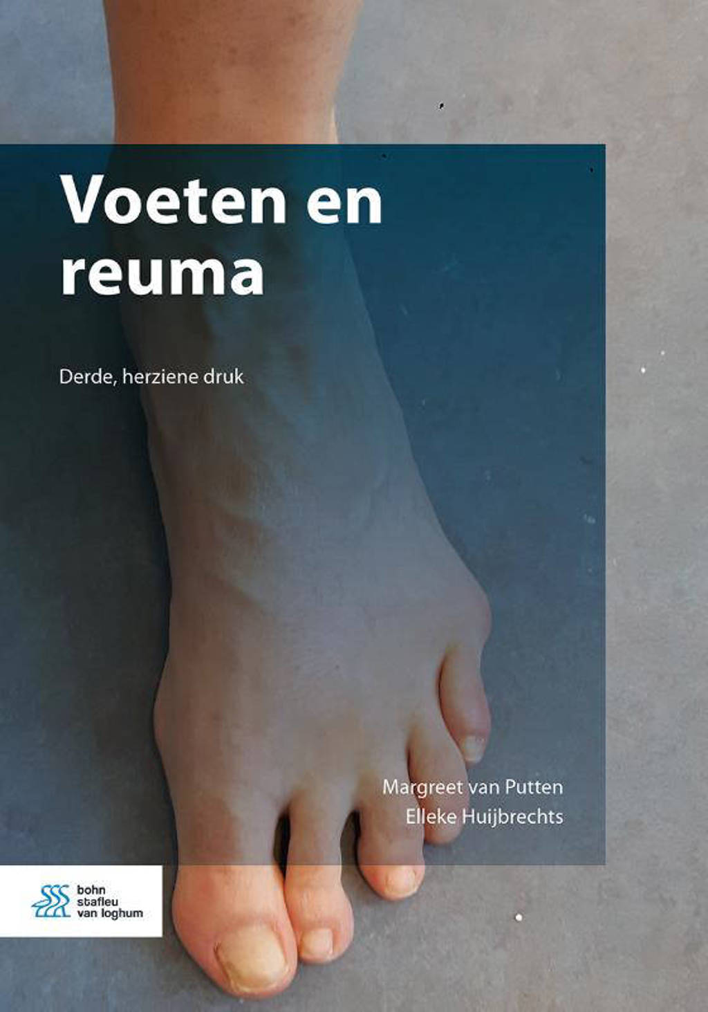 Voeten en reuma - Margreet van Putten en Elleke Huijbrechts