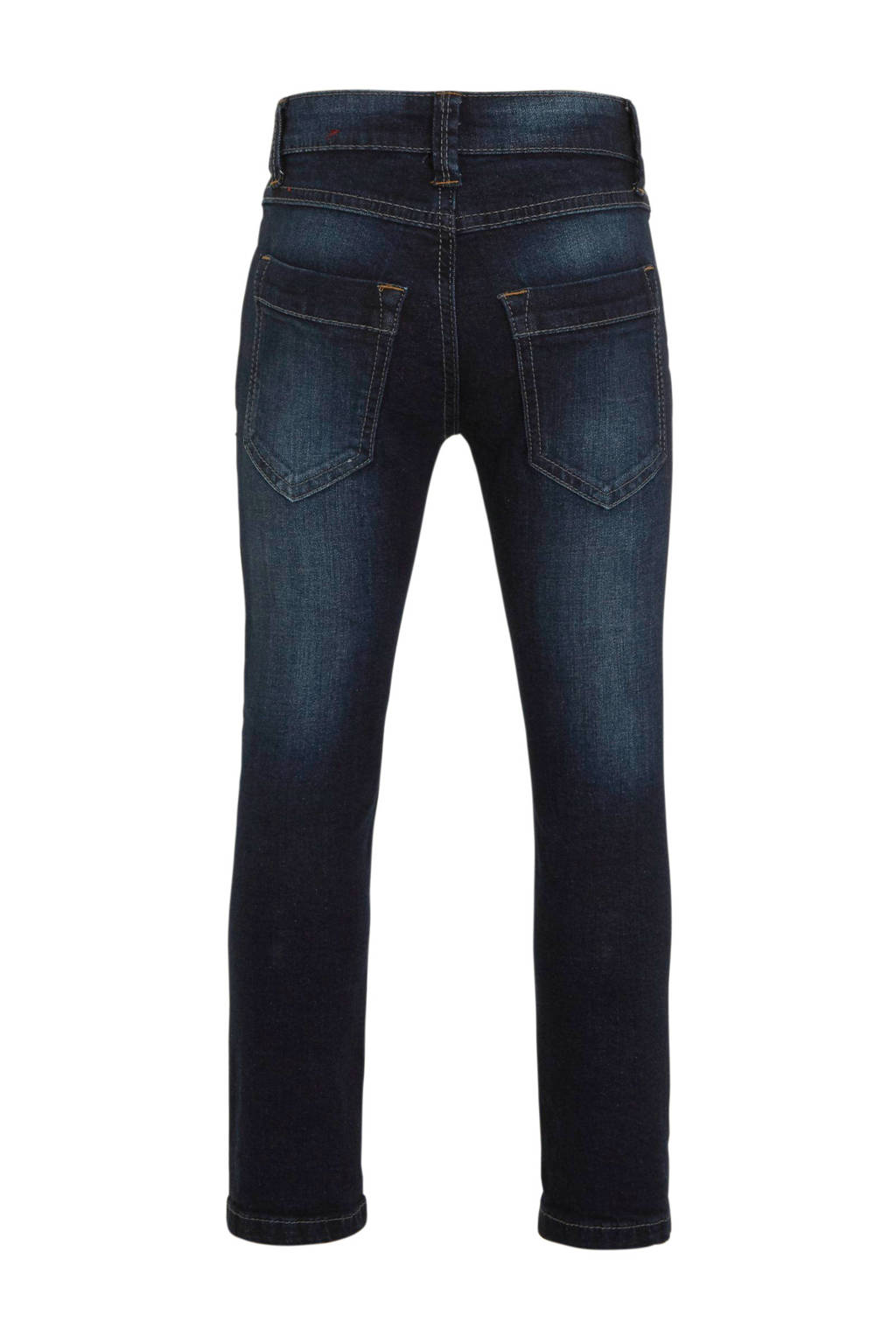 Bermuda S.oliver Bermuda Jeans S.Oliver Slim Per Bambini E Ragazzi - 98% Cotone, 2% Elastan, Vestibilità Aderente Jeans Corti Bambino