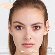 thumbnail: L'Oréal Paris True Match Radiant Serum concealer  - 1R - 11 ml