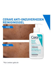 thumbnail: CeraVe Blemish Control Cleanser - 236 ml
