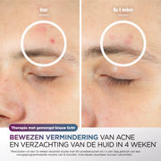 thumbnail: Shark CryoGlow LED-Masker met under-eye-cooling infraroodlamp - FW312EUPL