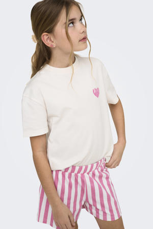 shortama KOGRILA roze