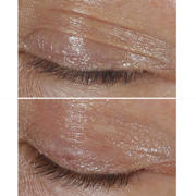 thumbnail: Clinique Smart Clinical Repair Rimpelcorrigerende Oogcrème